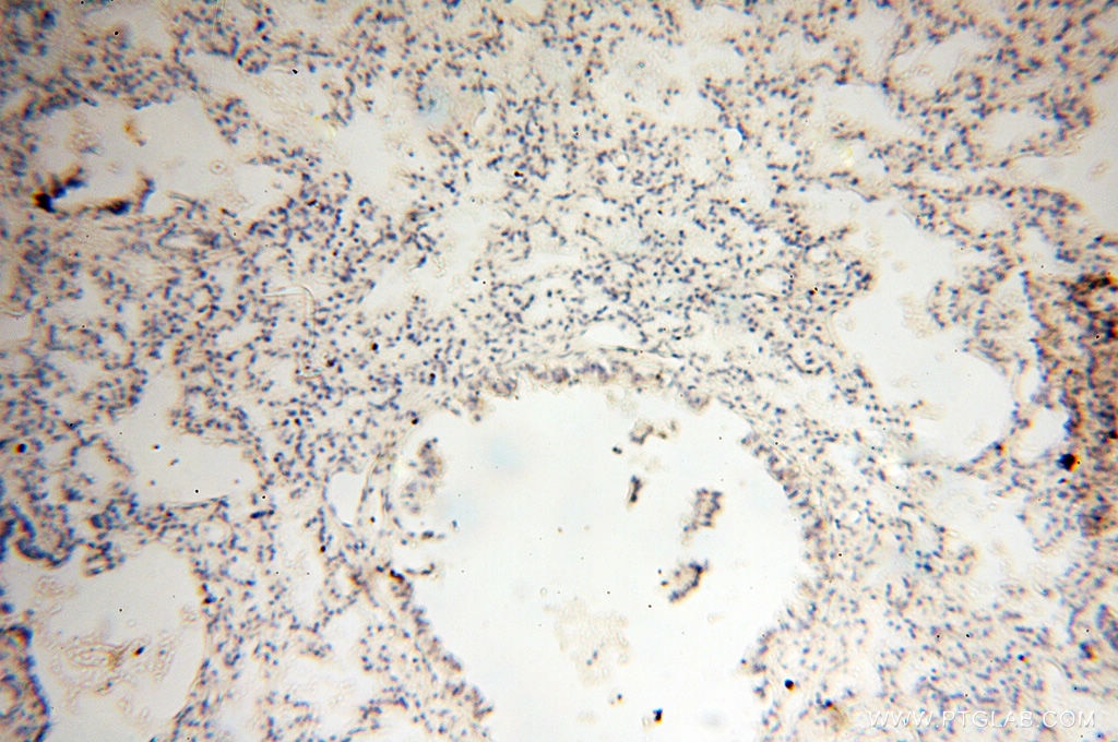 Immunohistochemistry (IHC) staining of human lung tissue using OSTF1 Polyclonal antibody (10671-1-AP)