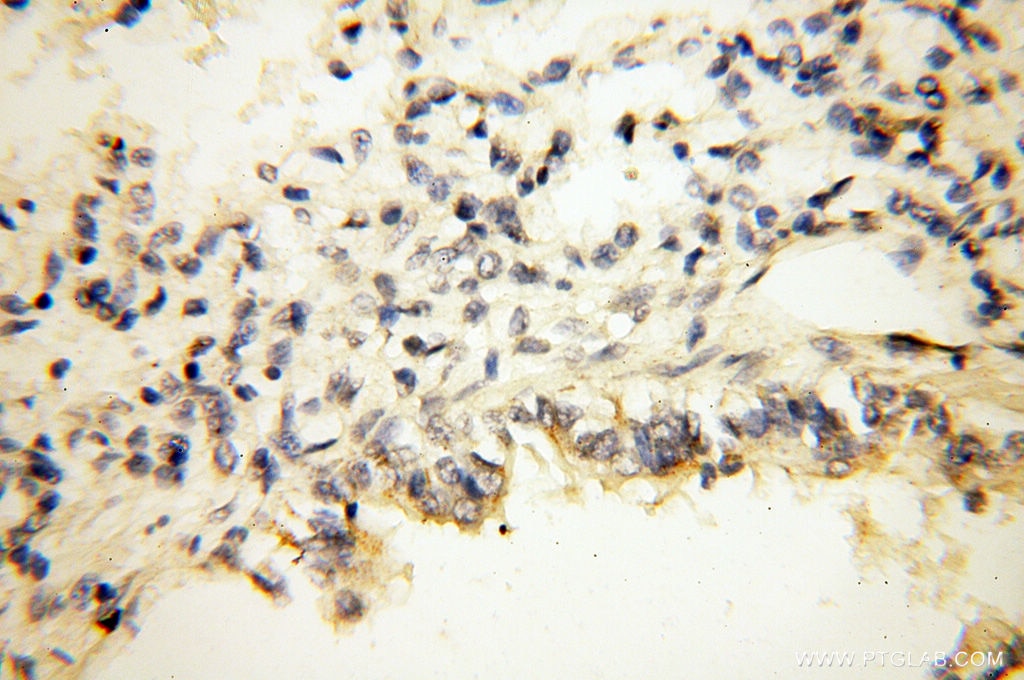 Immunohistochemistry (IHC) staining of human lung tissue using OSTF1 Polyclonal antibody (10671-1-AP)