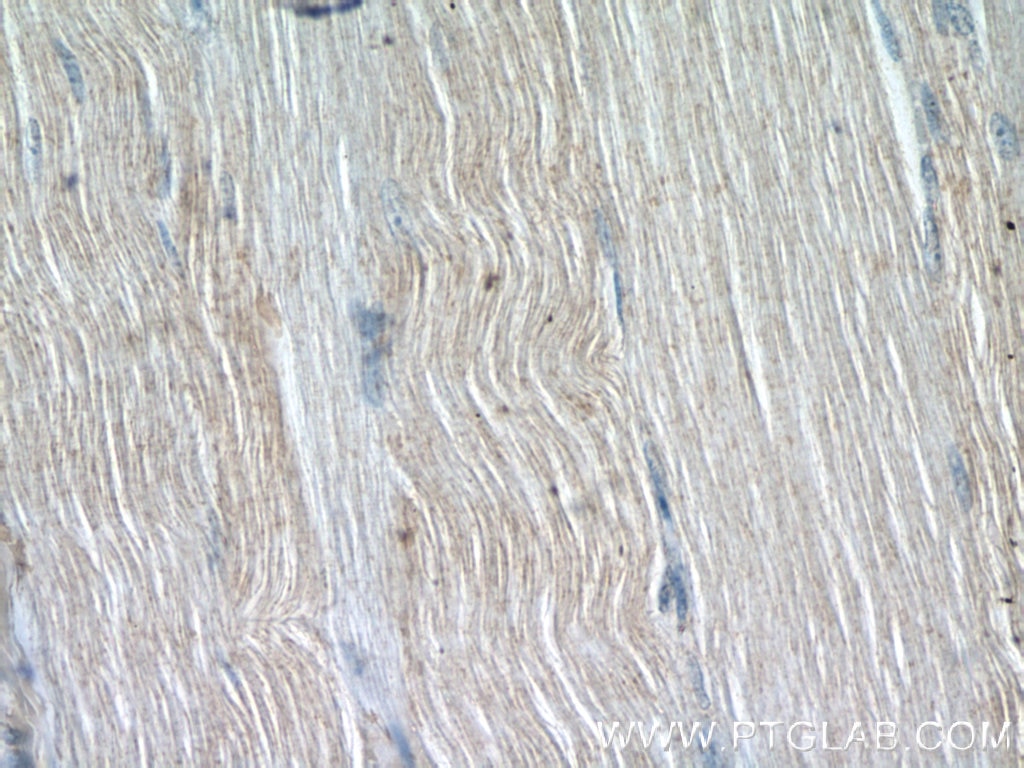 Immunohistochemistry (IHC) staining of human skeletal muscle tissue using OSTN Polyclonal antibody (25207-1-AP)