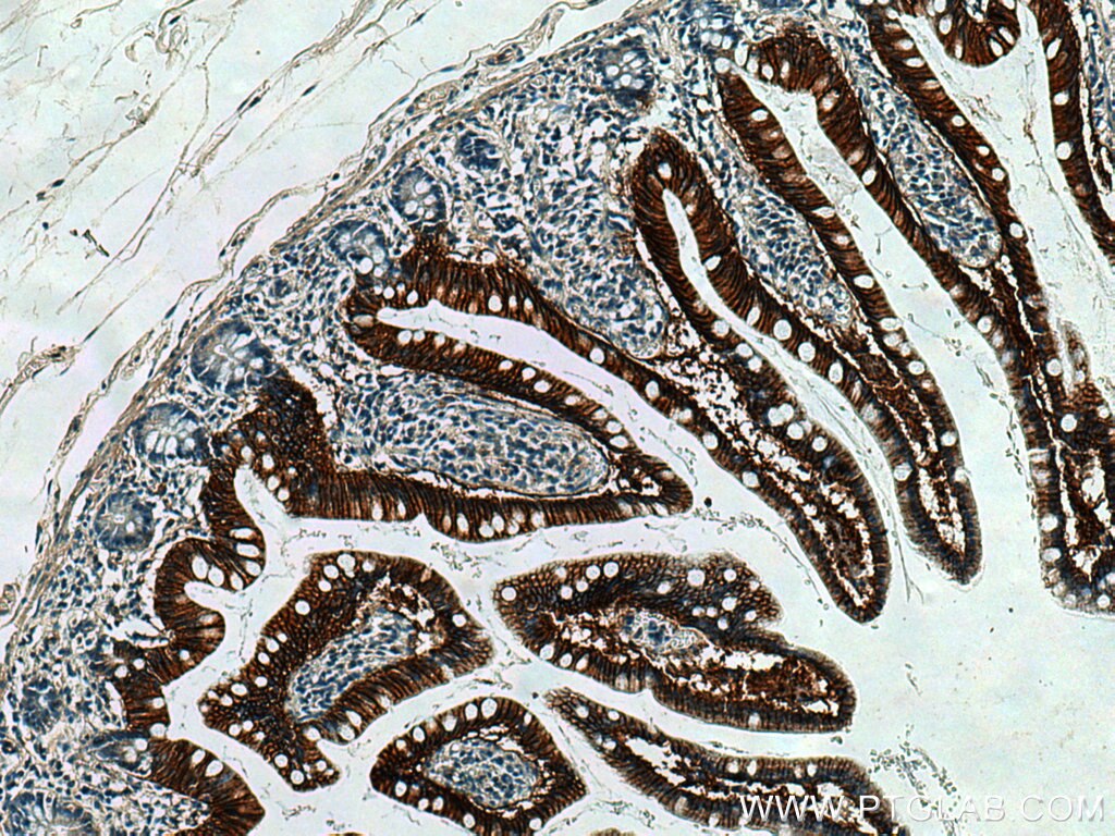 Immunohistochemistry (IHC) staining of human small intestine tissue using OSTbeta / SLC51B Polyclonal antibody (21248-1-AP)