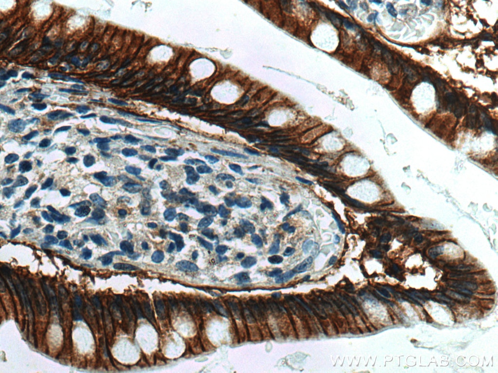 Immunohistochemistry (IHC) staining of human small intestine tissue using OSTbeta / SLC51B Polyclonal antibody (21248-1-AP)