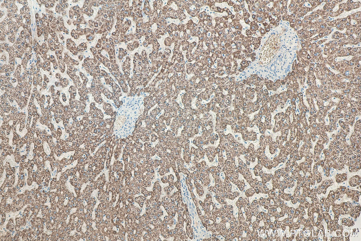 IHC staining of human liver using 67553-1-Ig