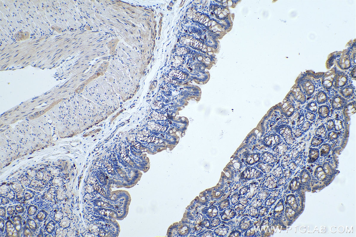 Immunohistochemistry (IHC) staining of rat colon tissue using OTC Monoclonal antibody (67553-1-Ig)