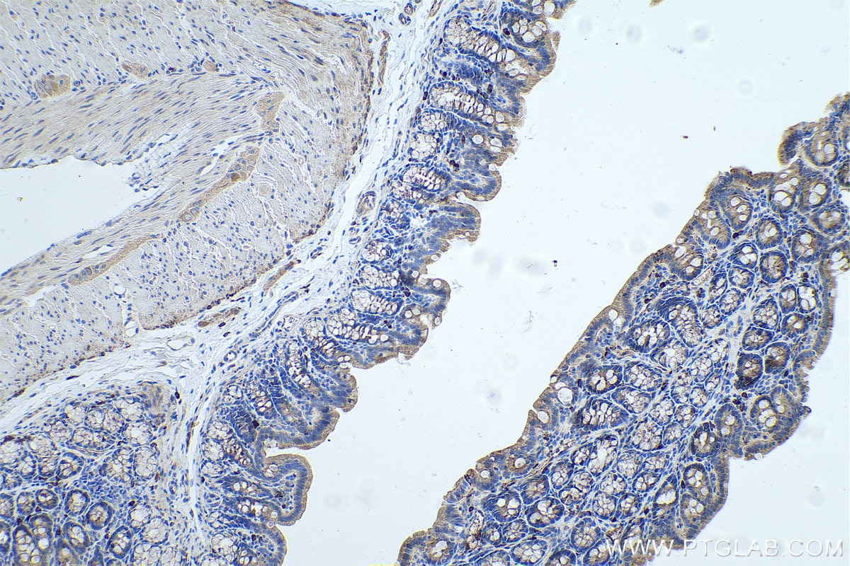 Immunohistochemistry (IHC) staining of rat colon tissue using OTC Monoclonal antibody (67553-1-Ig)