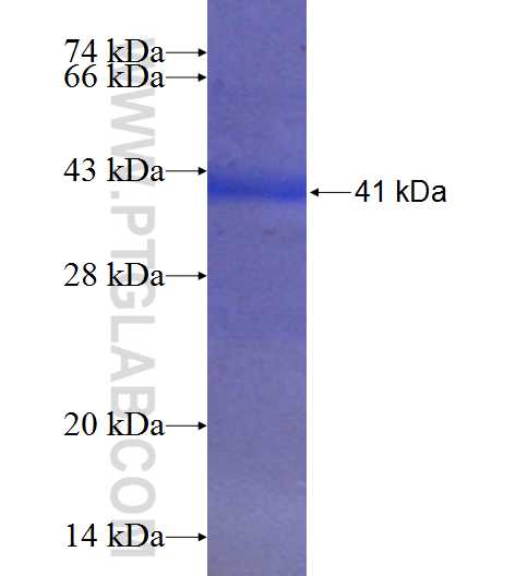 OTC fusion protein Ag24186 SDS-PAGE