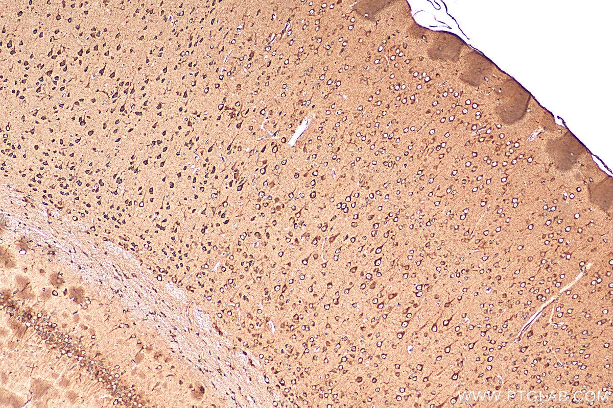 Immunohistochemistry (IHC) staining of mouse brain tissue using OTOF Polyclonal antibody (20721-1-AP)