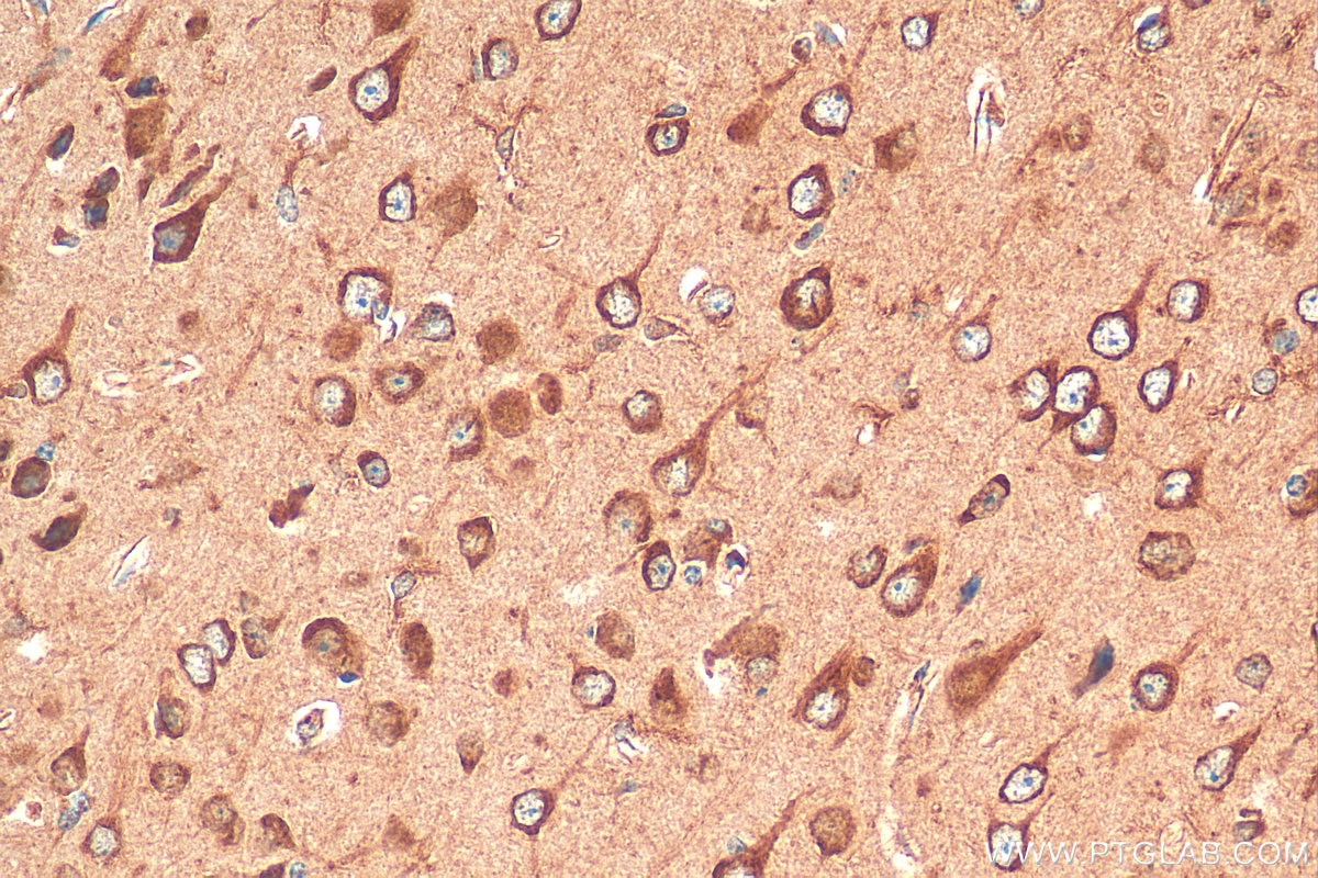 Immunohistochemistry (IHC) staining of mouse brain tissue using OTOF Polyclonal antibody (20721-1-AP)