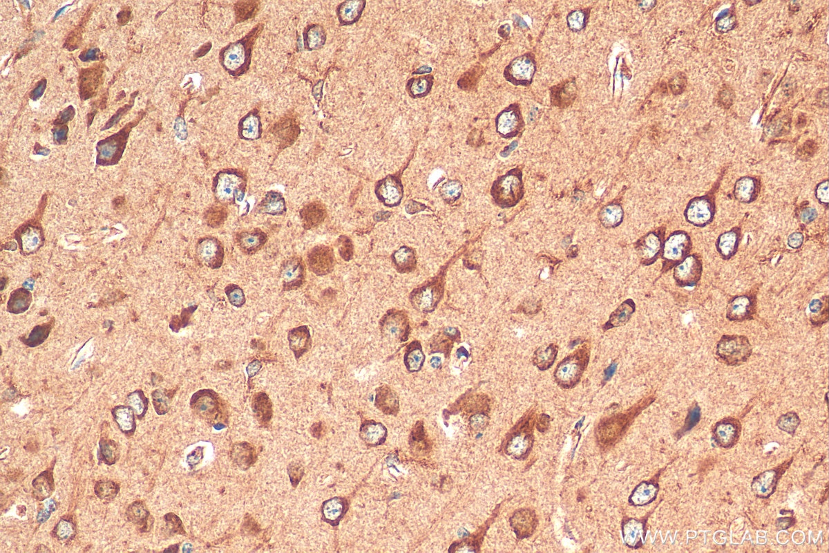 Immunohistochemistry (IHC) staining of mouse brain tissue using OTOF Polyclonal antibody (20721-1-AP)