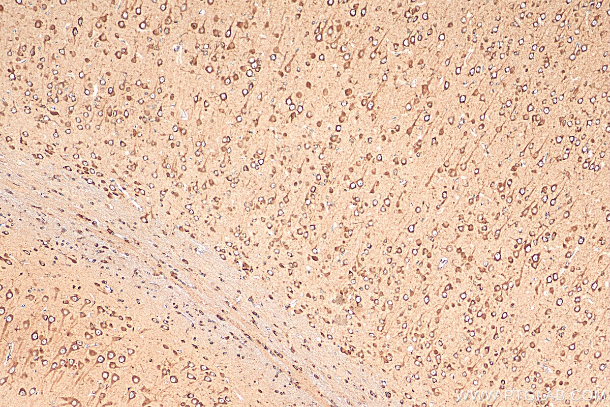 Immunohistochemistry (IHC) staining of rat brain tissue using OTOF Polyclonal antibody (20721-1-AP)