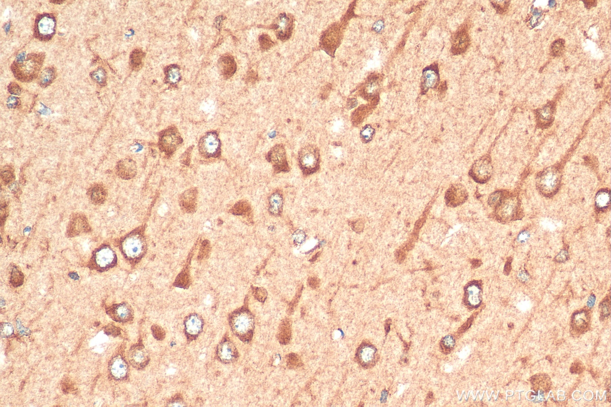 Immunohistochemistry (IHC) staining of rat brain tissue using OTOF Polyclonal antibody (20721-1-AP)