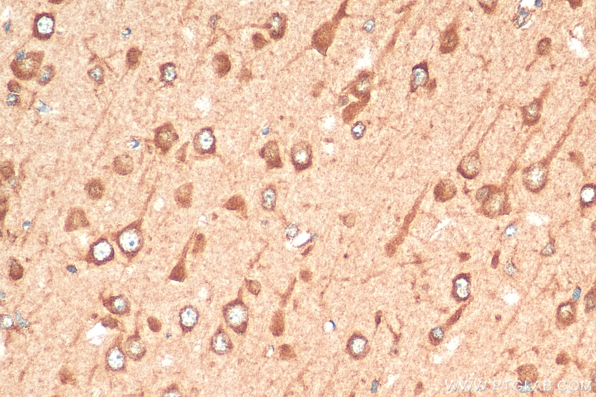 Immunohistochemistry (IHC) staining of rat brain tissue using OTOF Polyclonal antibody (20721-1-AP)