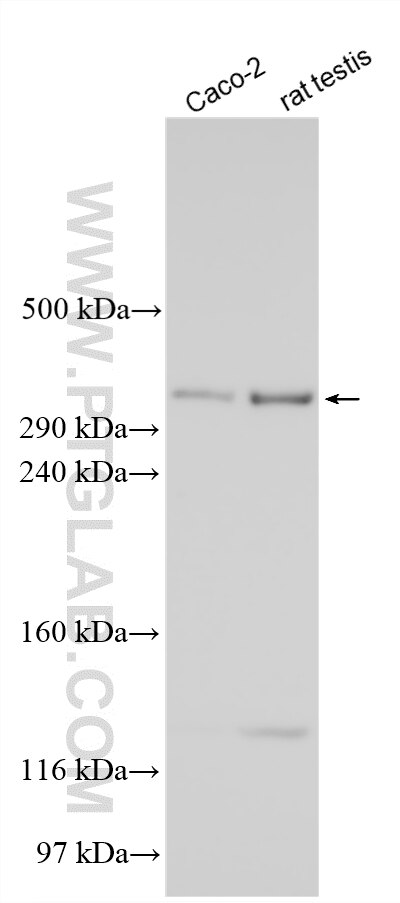 WB analysis using 33794-1-AP (same clone as 33794-1-PBS) Western Blot (WB) analysis of various lysates using OTOG Polyclonal antibody (33794-1-AP)