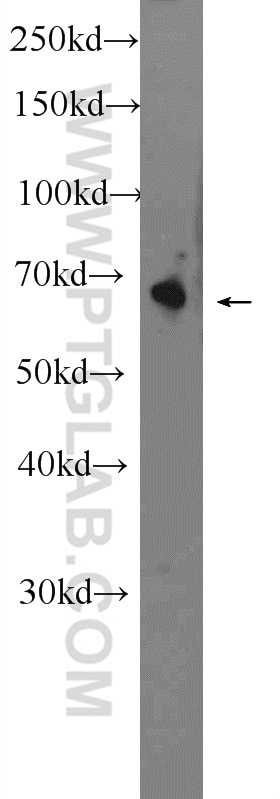 Western Blot (WB) analysis of mouse heart tissue using OTOP1 Polyclonal antibody (24456-1-AP)
