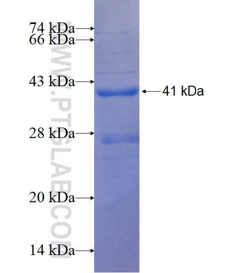 OTOP1 fusion protein Ag20011 SDS-PAGE
