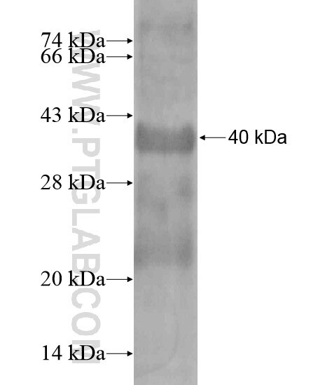 OTOP2 fusion protein Ag20176 SDS-PAGE OTOP2 fusion protein Ag20176 SDS-PAGE