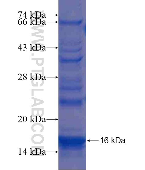 OTOP2 fusion protein Ag20218 SDS-PAGE