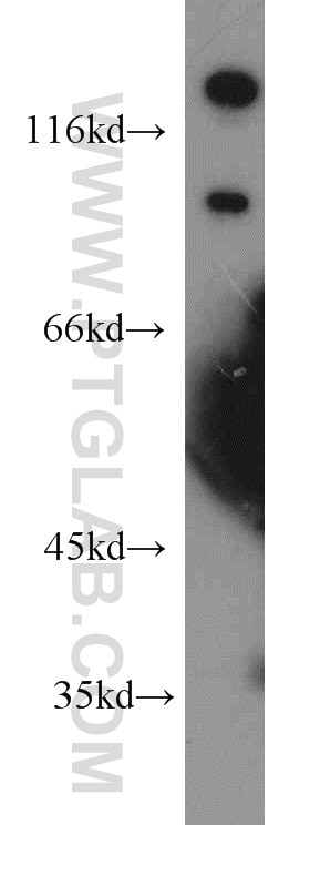 Western Blot (WB) analysis of mouse brain tissue using OTOP3 Polyclonal antibody (18819-1-AP)