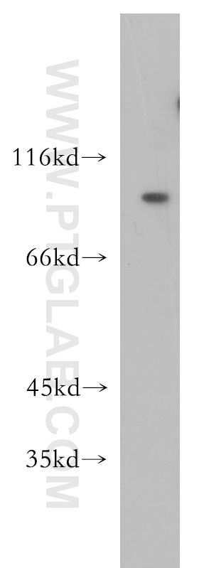 Western Blot (WB) analysis of MCF-7 cells using OTOP3 Polyclonal antibody (18819-1-AP)