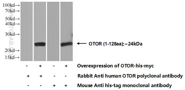 WB analysis of Transfected HEK-293 using 18132-1-AP