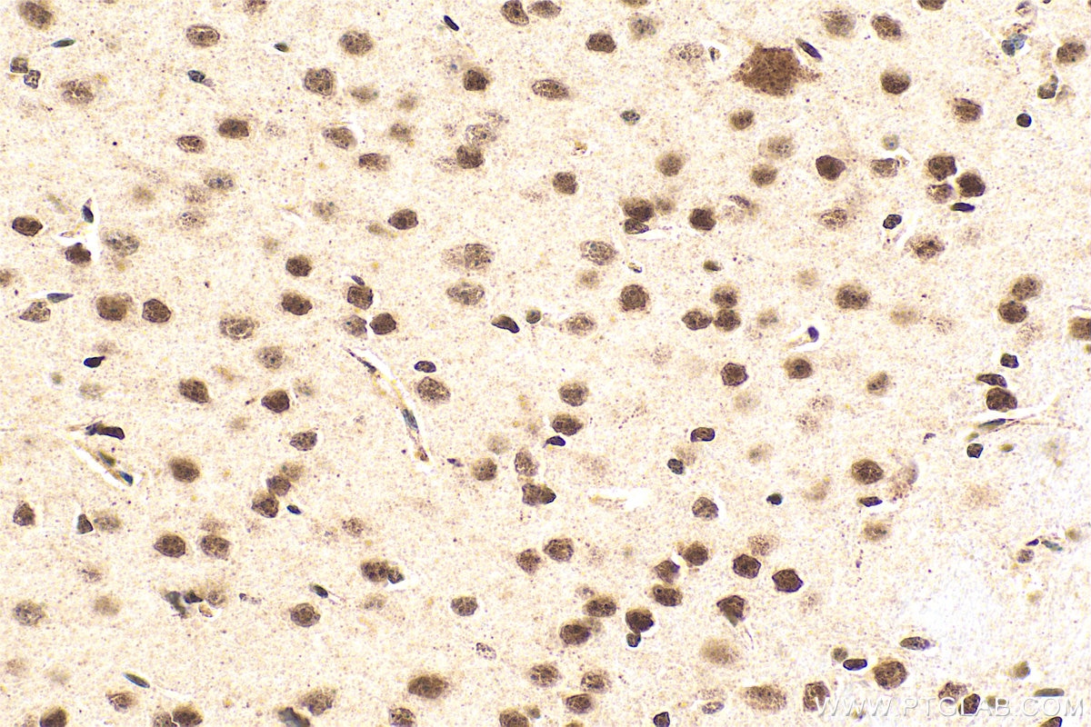 IHC staining of mouse brain using 14585-1-AP Immunohistochemistry (IHC) staining of mouse brain tissue using OTP Polyclonal antibody (14585-1-AP)