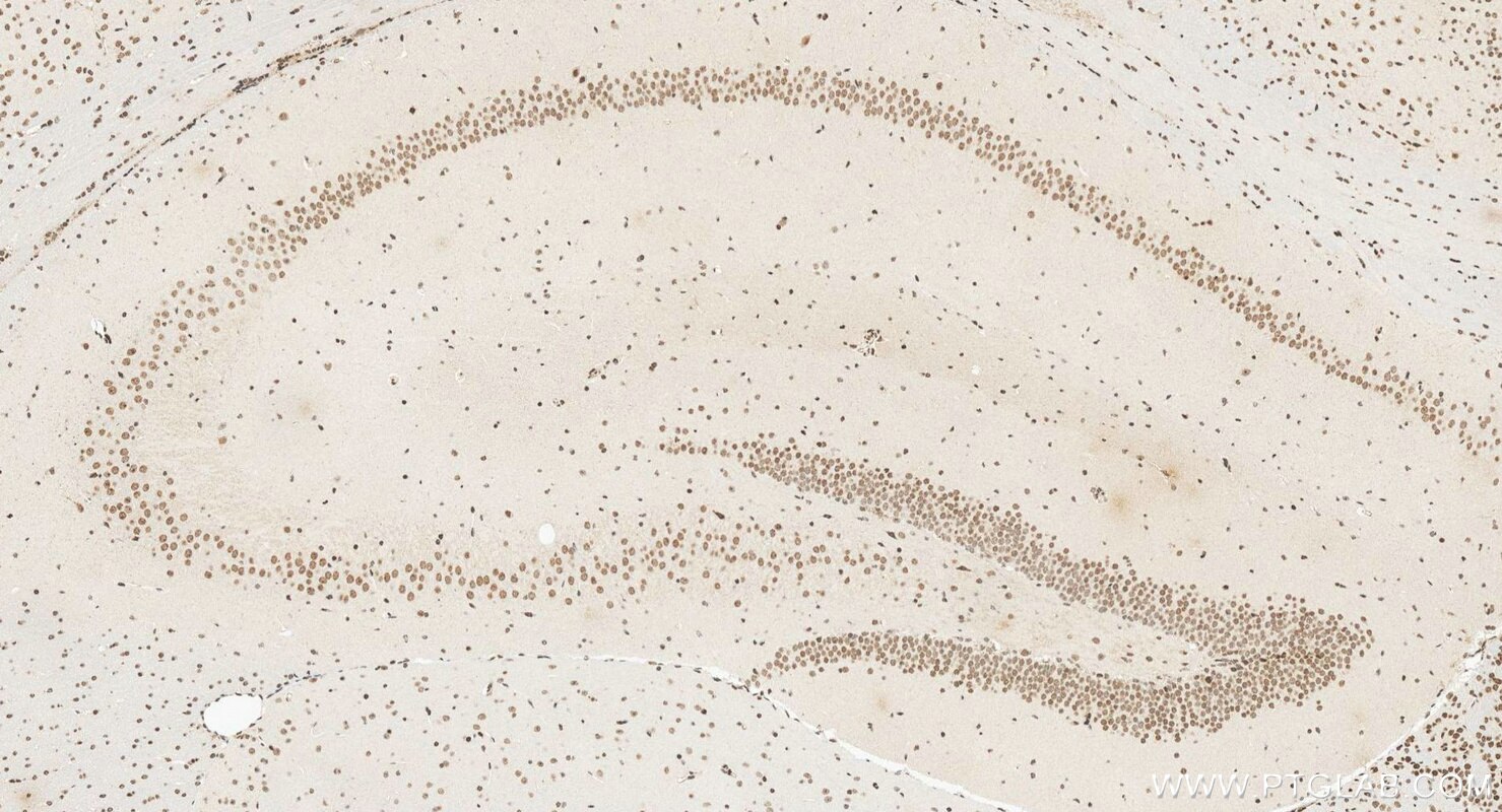 IHC staining of mouse brain using 14585-1-AP Immunohistochemistry (IHC) staining of mouse brain tissue using OTP Polyclonal antibody (14585-1-AP)