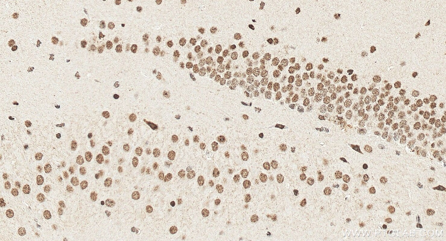 IHC staining of mouse brain using 14585-1-AP Immunohistochemistry (IHC) staining of mouse brain tissue using OTP Polyclonal antibody (14585-1-AP)