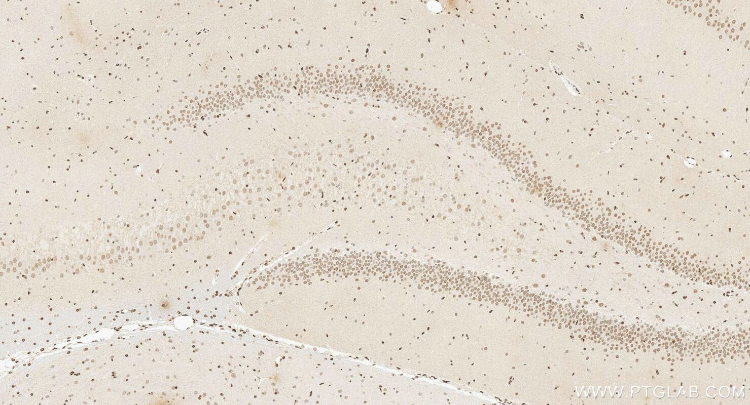 IHC staining of rat brain using 14585-1-AP Immunohistochemistry (IHC) staining of rat brain tissue using OTP Polyclonal antibody (14585-1-AP)