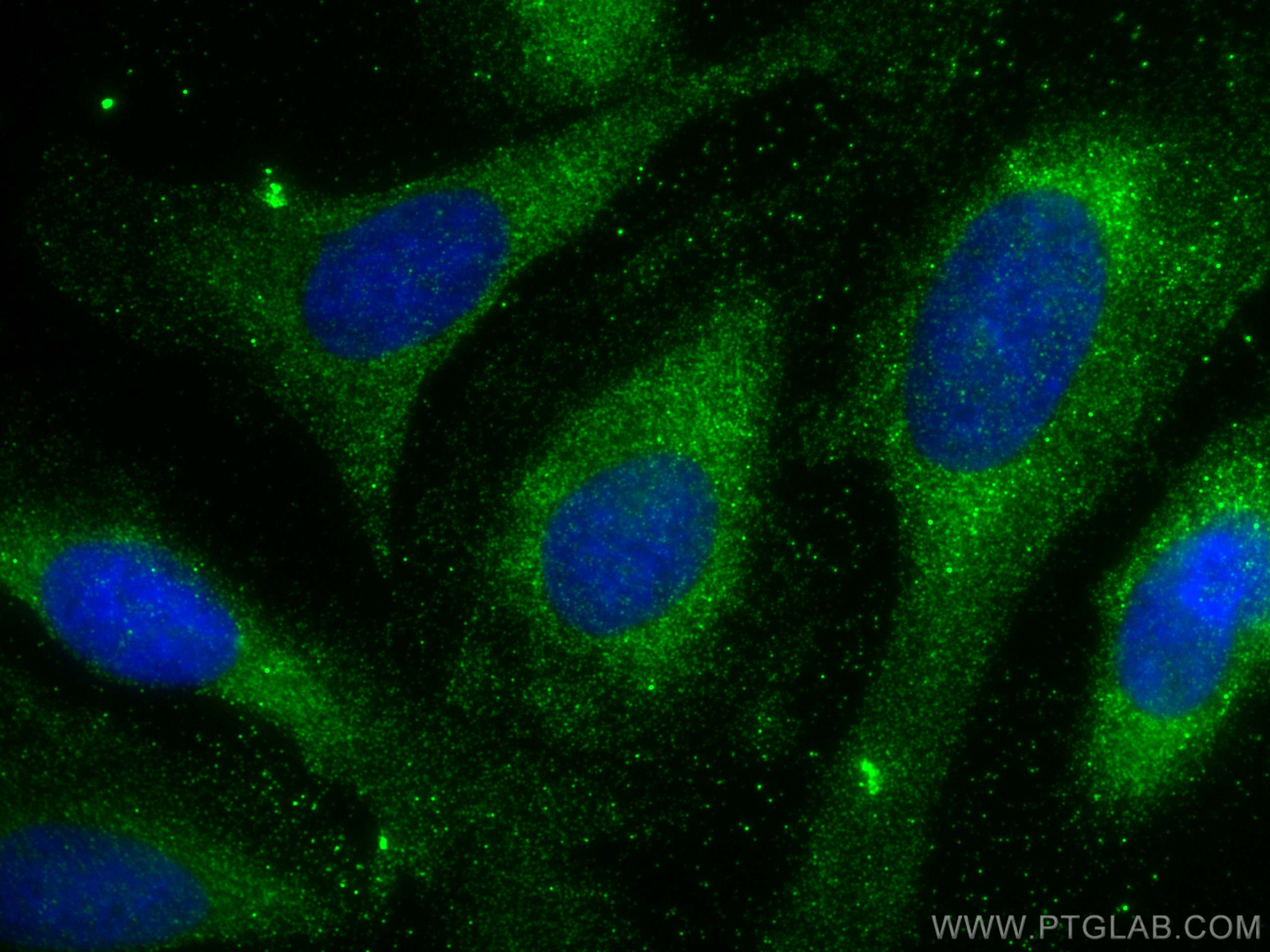 Immunofluorescence (IF) / fluorescent staining of U2OS cells using OTUB1 Polyclonal antibody (10573-1-AP)