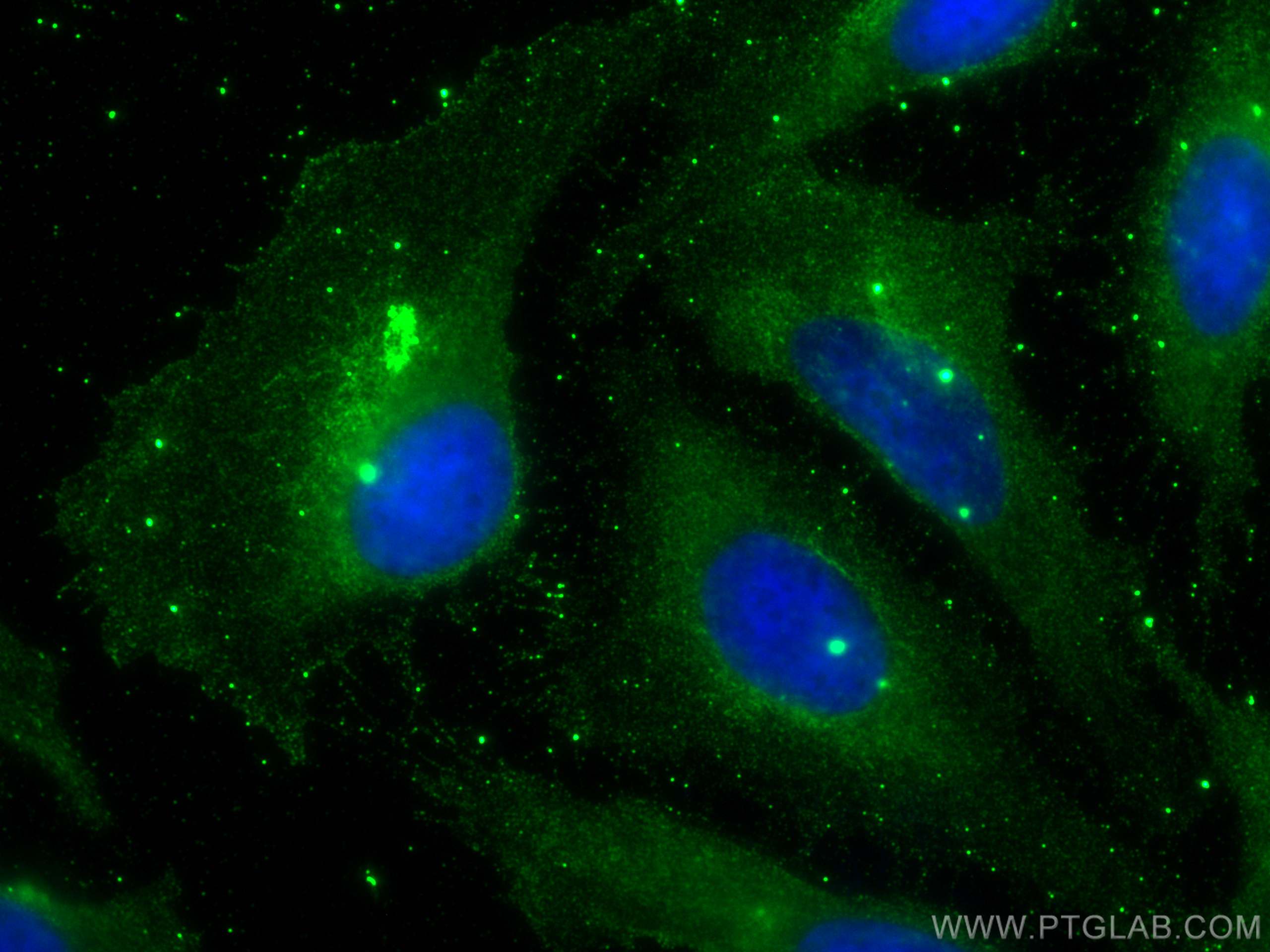 Immunofluorescence (IF) / fluorescent staining of U2OS cells using OTUB1 Monoclonal antibody (68489-1-Ig)