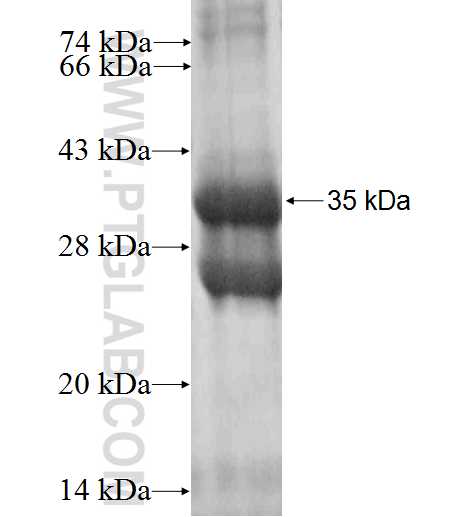 OTUB2 fusion protein Ag2703 SDS-PAGE