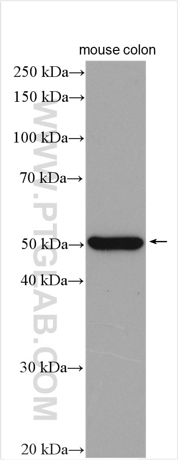 Western Blot (WB) analysis of mouse colon tissue using OTUD1 Polyclonal antibody (29921-1-AP)