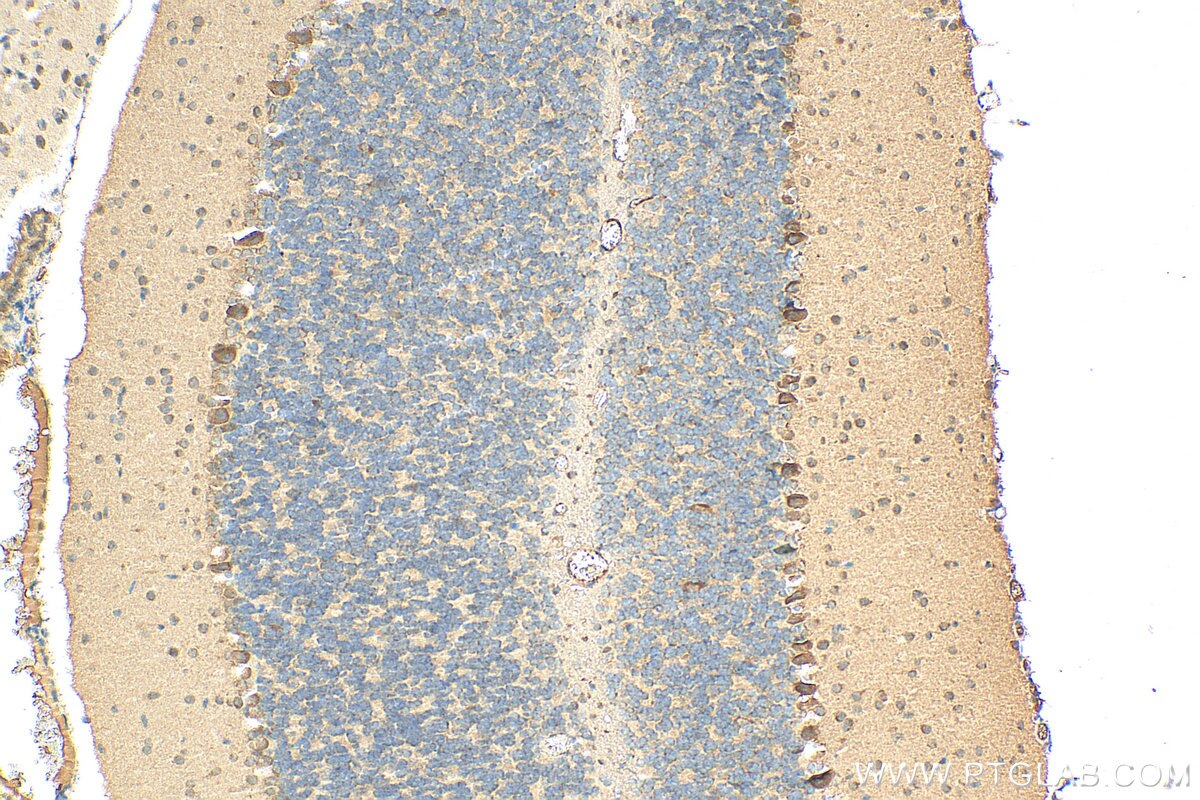 Immunohistochemistry (IHC) staining of mouse cerebellum tissue using OTUD3 Polyclonal antibody (29622-1-AP)