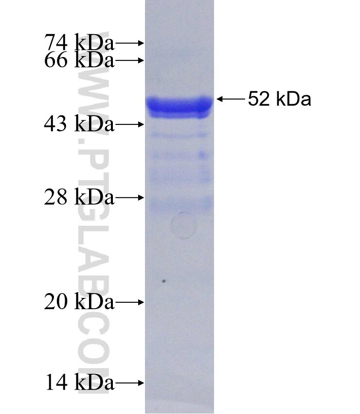 OTUD3 fusion protein Ag30425 SDS-PAGE