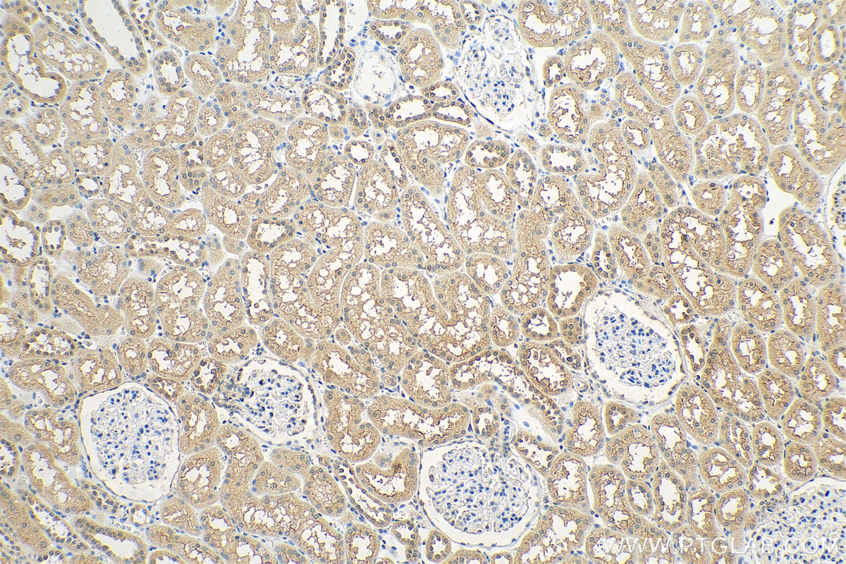 IHC staining of human kidney using 25070-1-AP