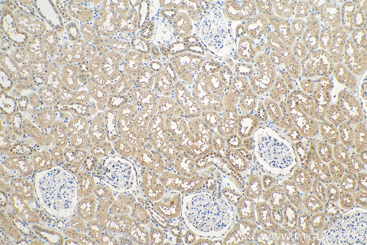 Immunohistochemistry (IHC) staining of human kidney tissue using OTUD4 Polyclonal antibody (25070-1-AP)