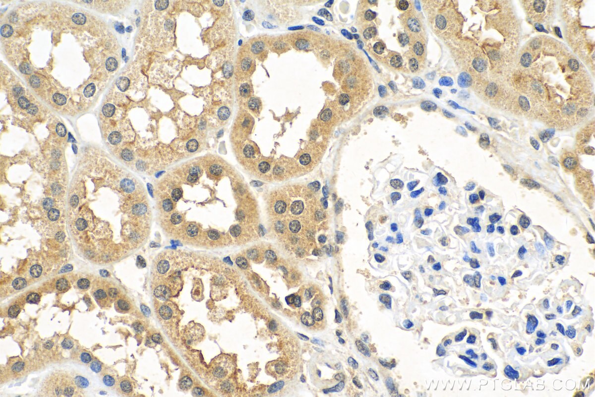 Immunohistochemistry (IHC) staining of human kidney tissue using OTUD4 Polyclonal antibody (25070-1-AP)