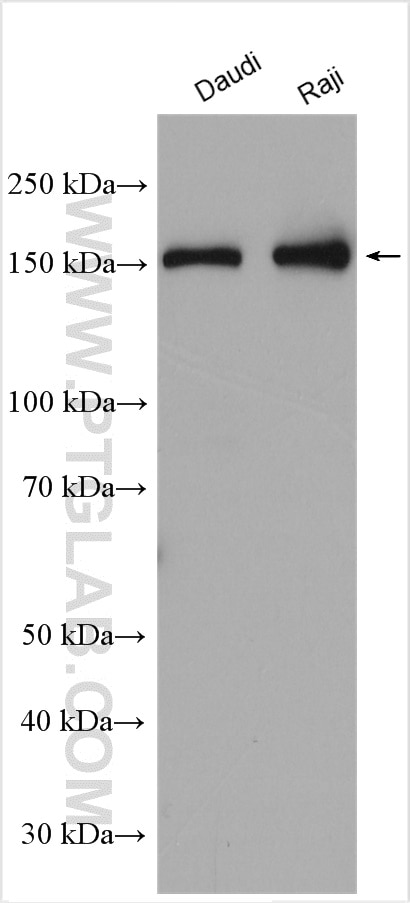 Western Blot (WB) analysis of various lysates using OTUD4 Polyclonal antibody (25070-1-AP)