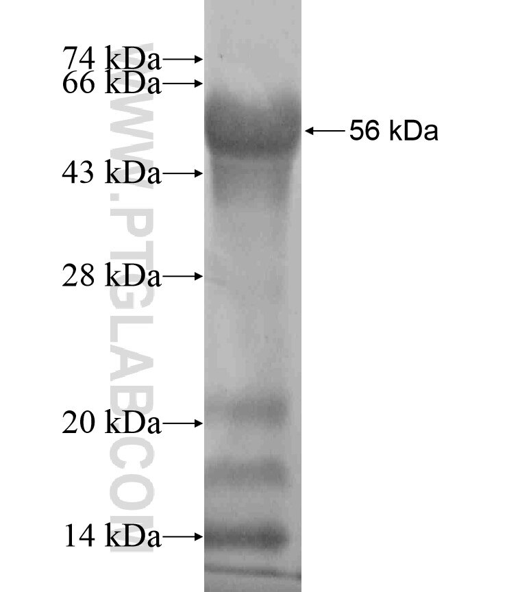 OTUD4 fusion protein Ag18145 SDS-PAGE