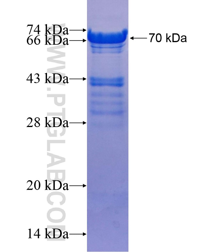 OTUD4 fusion protein Ag18401 SDS-PAGE