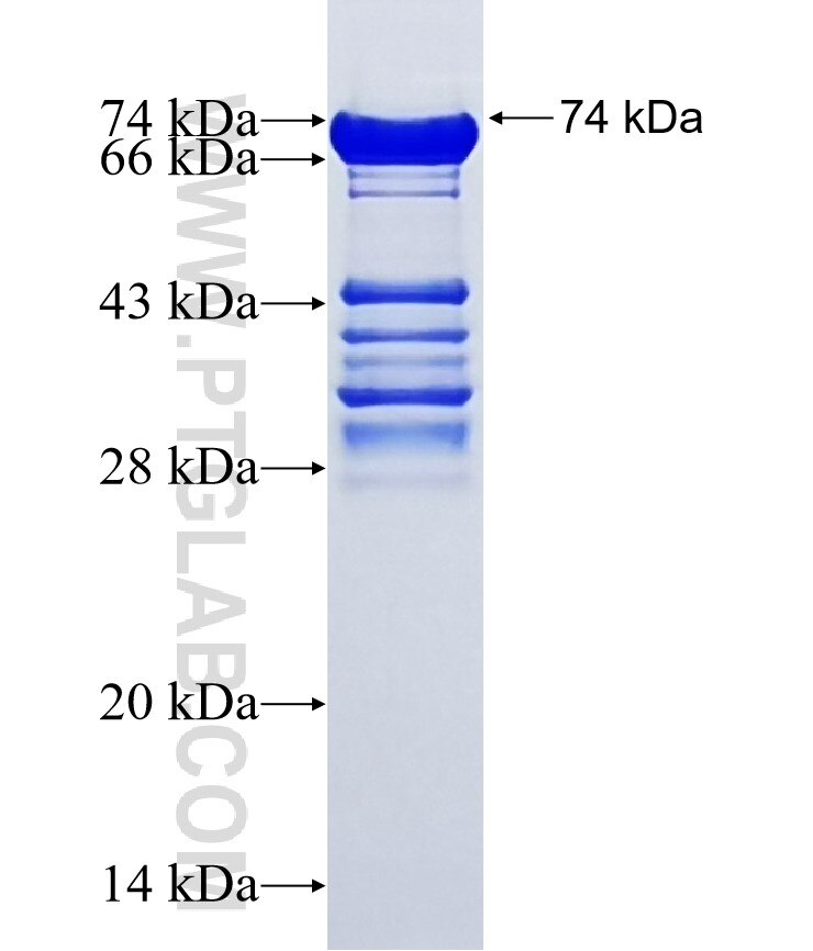 OTUD4 fusion protein Ag18401 SDS-PAGE