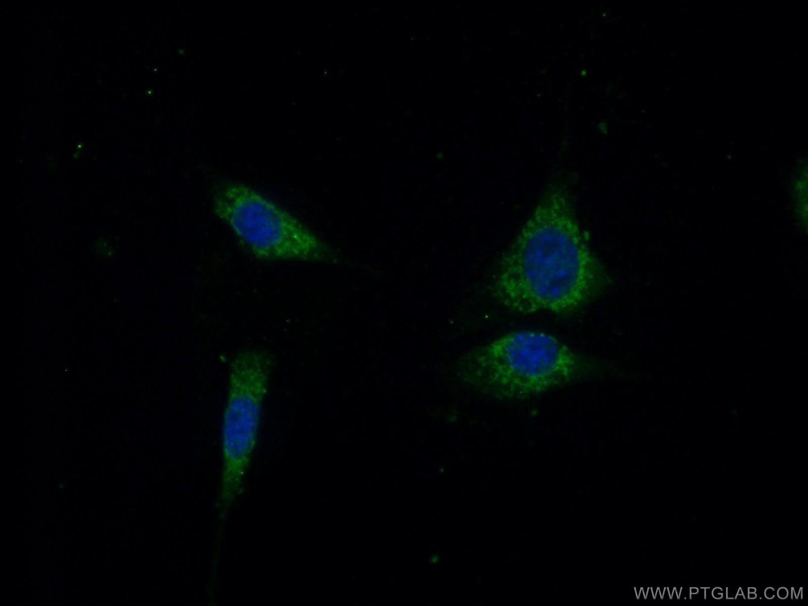 Immunofluorescence (IF) / fluorescent staining of NIH/3T3 cells using OTUD5 Polyclonal antibody (21002-1-AP)