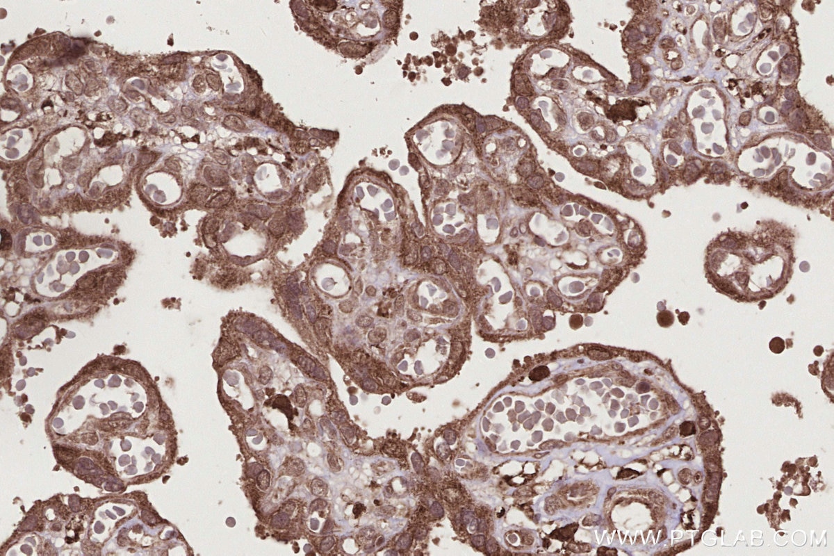 Immunohistochemistry (IHC) staining of human placenta tissue using OTUD5 Polyclonal antibody (21002-1-AP)