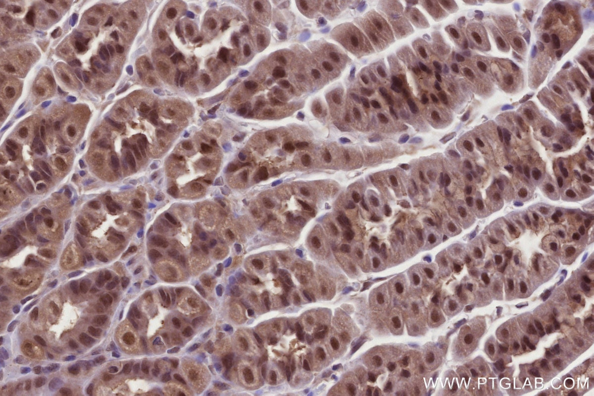 Immunohistochemistry (IHC) staining of mouse stomach tissue using OTUD5 Polyclonal antibody (21002-1-AP)