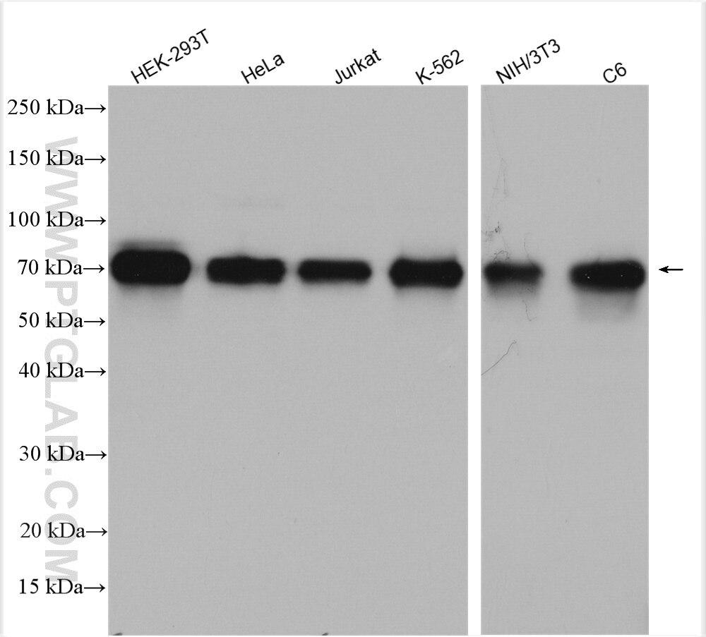 Western Blot (WB) analysis of various lysates using OTUD5 Polyclonal antibody (21002-1-AP)