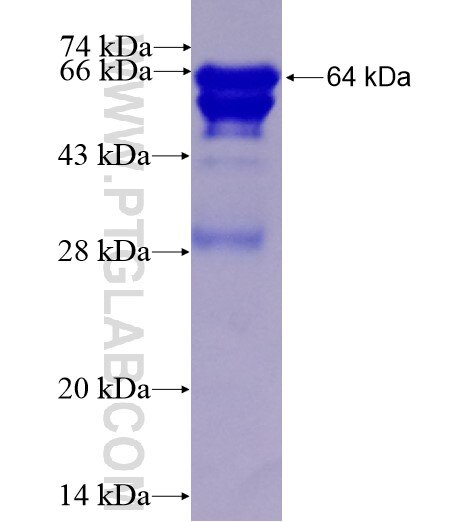 OTUD5 fusion protein Ag15190 SDS-PAGE