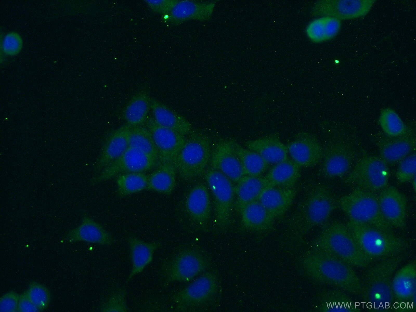 Immunofluorescence (IF) / fluorescent staining of MCF-7 cells using OTUD6A Polyclonal antibody (24486-1-AP)