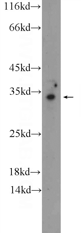 Western Blot (WB) analysis of MCF-7 cells using OTUD6A Polyclonal antibody (24486-1-AP)