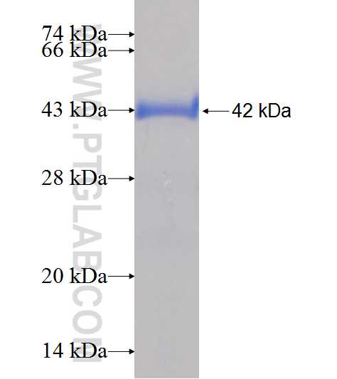 OTUD6A fusion protein Ag21639 SDS-PAGE