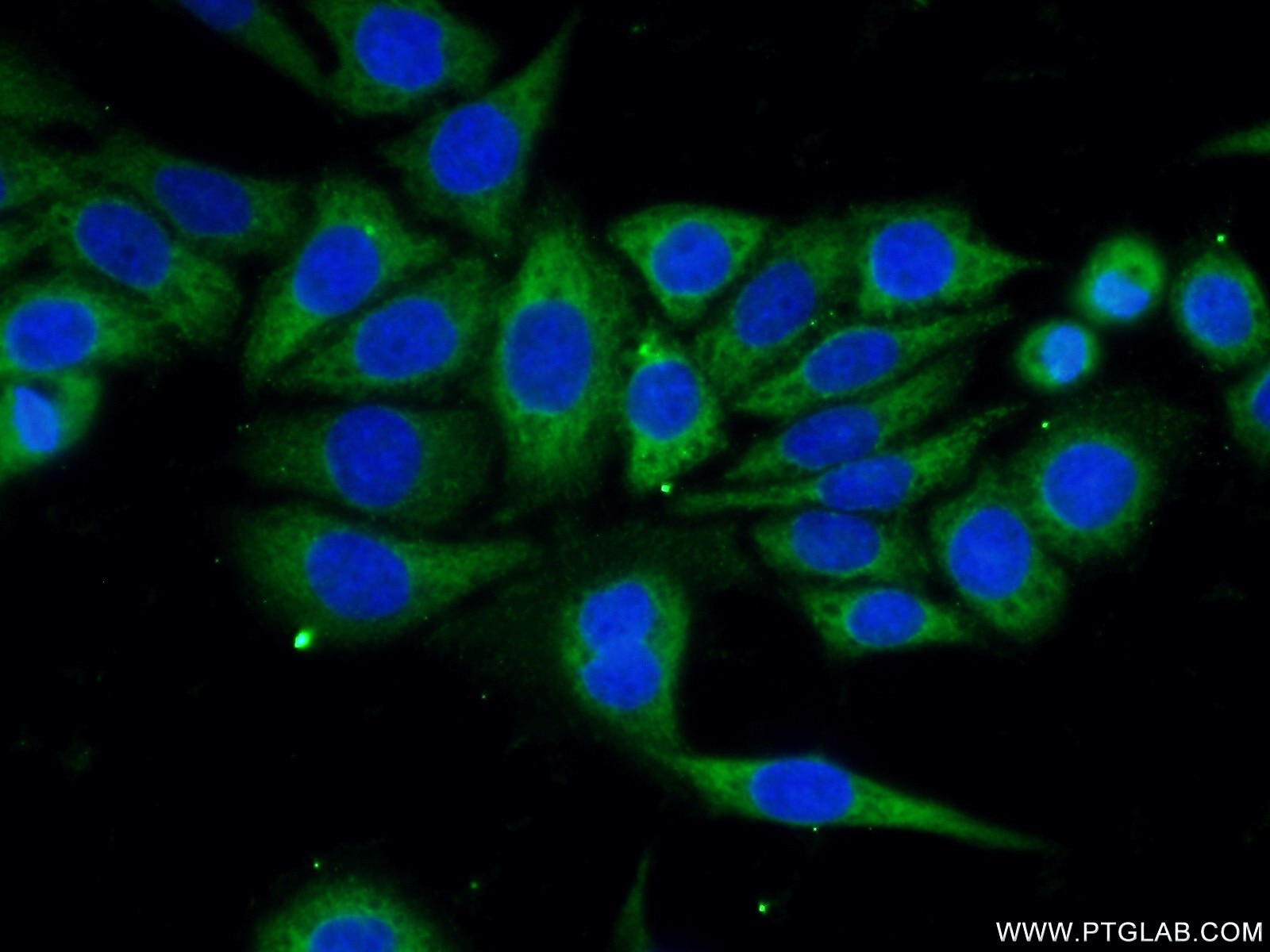 Immunofluorescence (IF) / fluorescent staining of PC-3 cells using OTUD6B Polyclonal antibody (25430-1-AP)