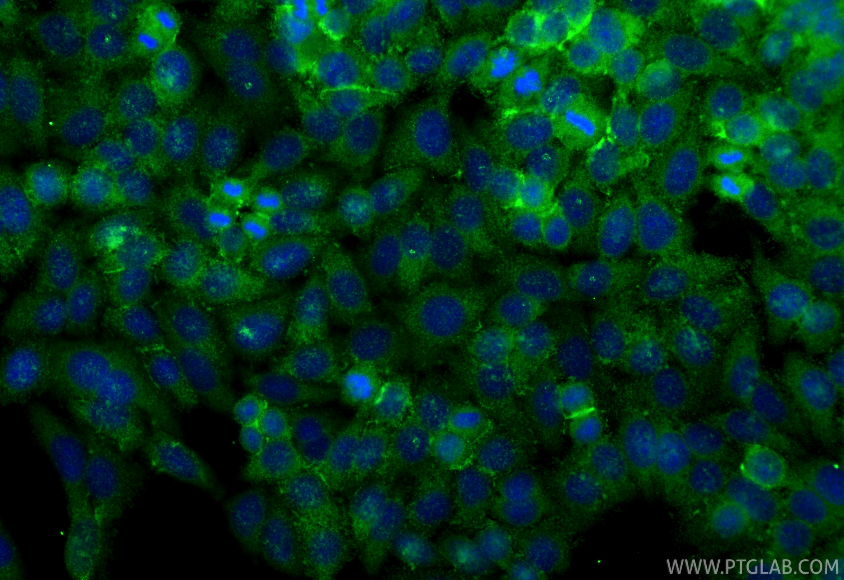 Immunofluorescent analysis of (-20°C Ethanol) fixed HepG2 cells using OTUD6B antibody (25430-1-AP) at dilution of 1:400 and CoraLite®488-Conjugated Goat Anti-Rabbit IgG(H+L) (SA00013-2). Immunofluorescence (IF) / fluorescent staining of HepG2 cells using OTUD6B Polyclonal antibody (25430-1-AP)